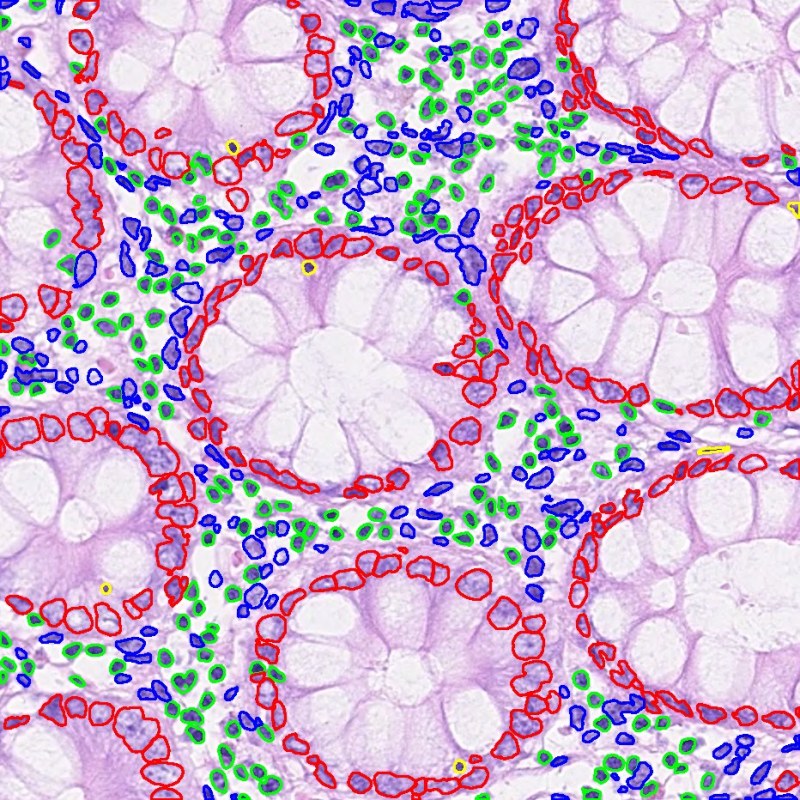 Digital Pathology Software MICAIA_AI_Cell_Segmentation_HE_Benestar_Tech